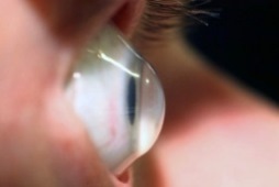 Keratoconus