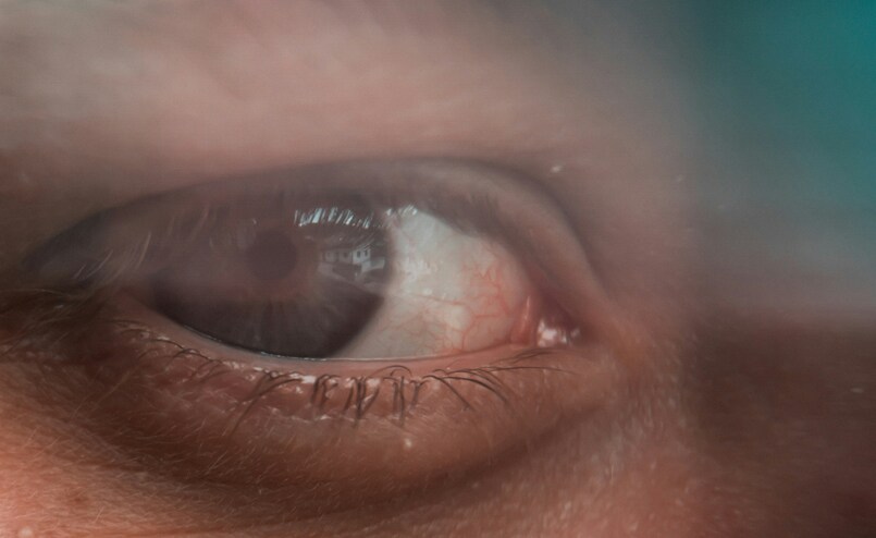 leczenie zaćmy z korekcją astygm