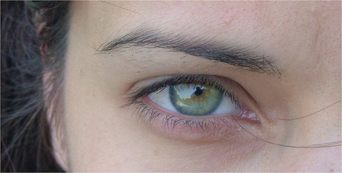 oko retinopatia barwnikowa