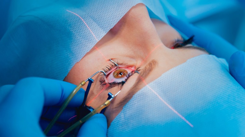 operacja zaćmy badania kwalifikacyjne